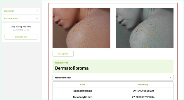Skin Analyzing System – demo
